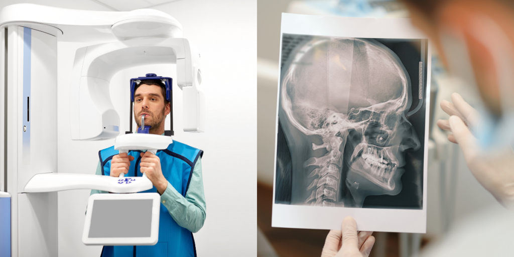 CT-Scan-1024×512 CT-Scan-1024x512
